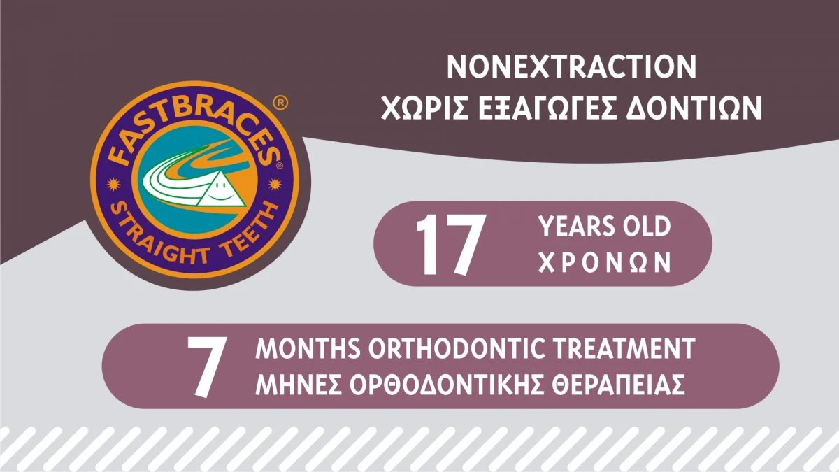 Fastbraces.gr - Περιστατικά Θεραπευμένα στις Κλινικές μας