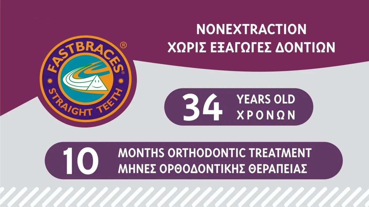 Fastbraces.gr - Περιστατικά Θεραπευμένα στις Κλινικές μας 24